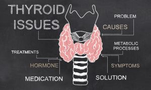 4 Things That Could Be Messing with Your Thyroid