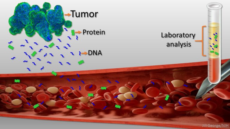 liquid biopsy